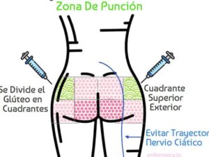 ️Cómo administrar una inyección intramuscular en el glúteo sin dolor【 ️ ...
