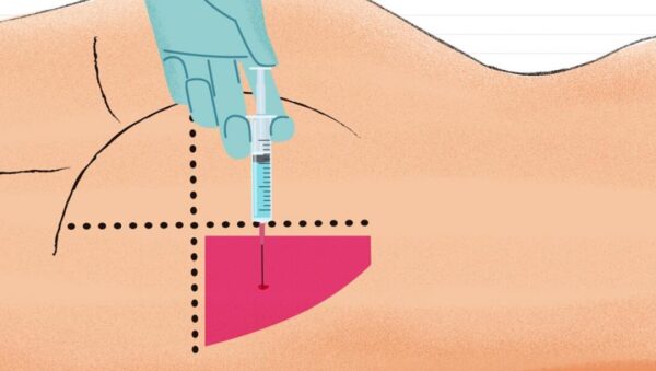 Inyectarse ️Cómo aplicar una inyección intramuscular correctamente【 ️】ProyectoFactoria